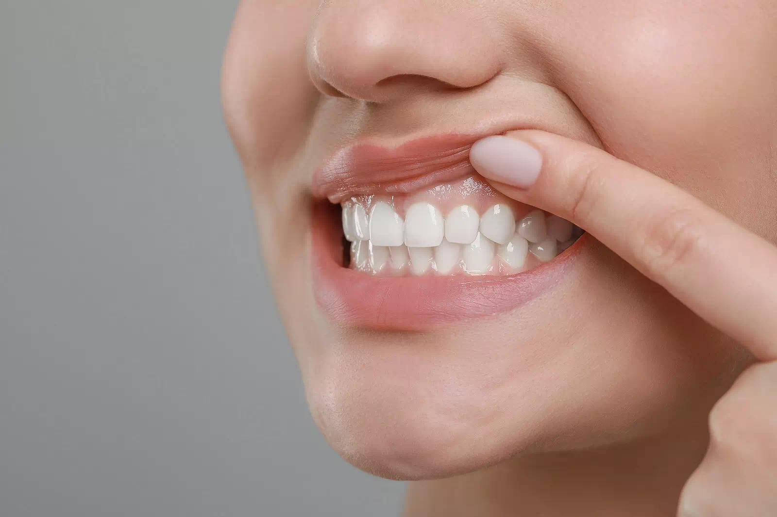 表側矯正のイメージ画像